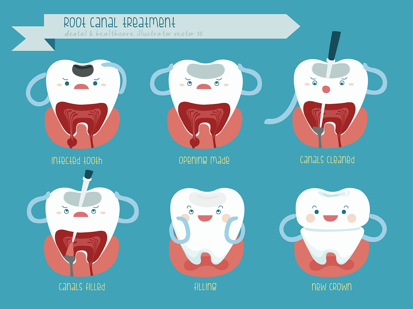 Can Root Canal Affect the Brain?