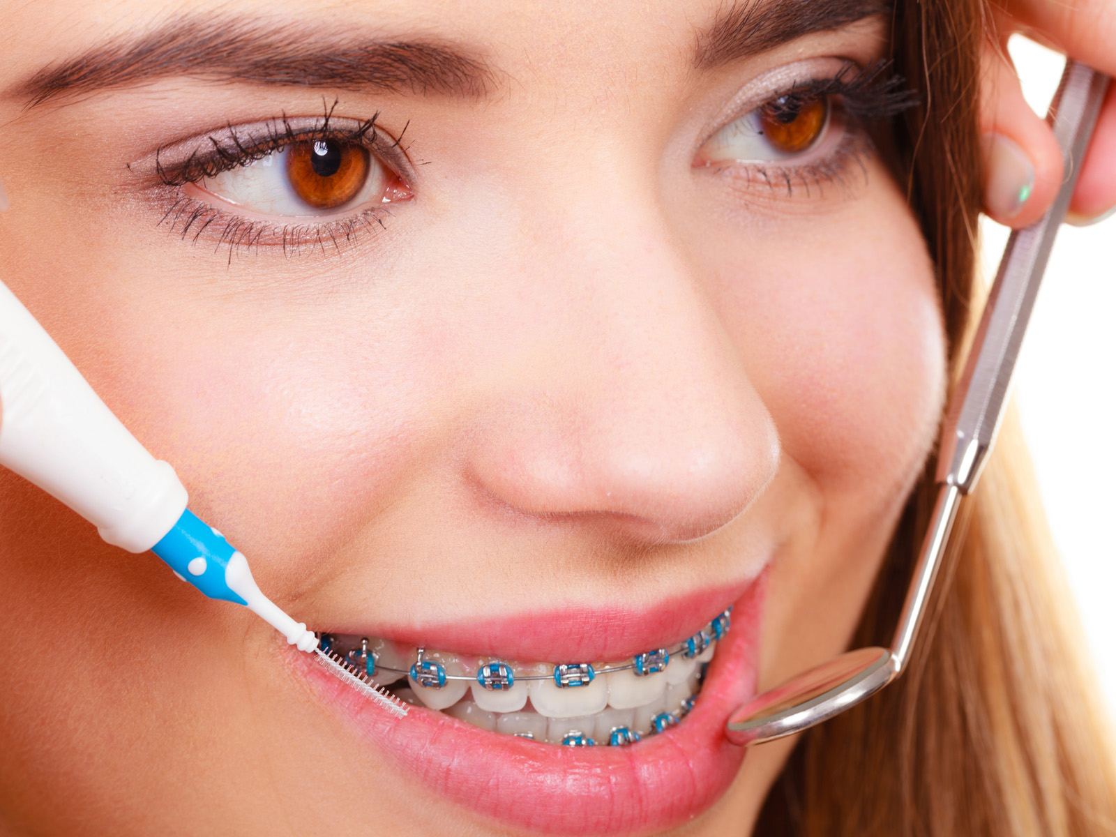 Do braces weaken teeth?