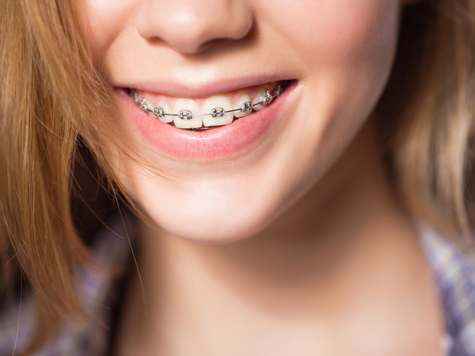 What Happens if Your Teeth Aren’t Straight After Braces?