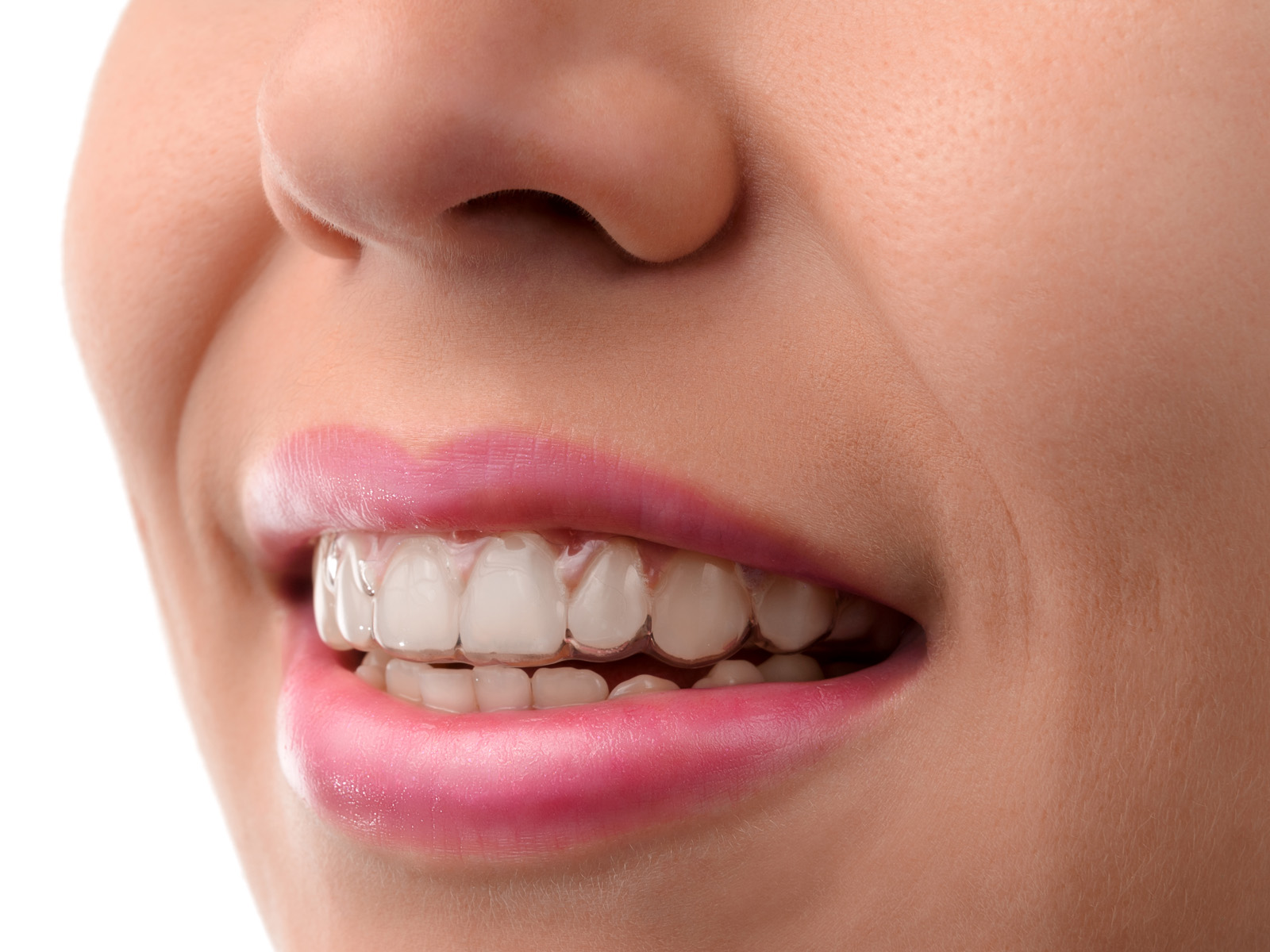 Does Invisalign make teeth bigger?