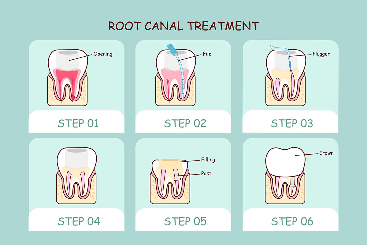 Dentist at Azle TX