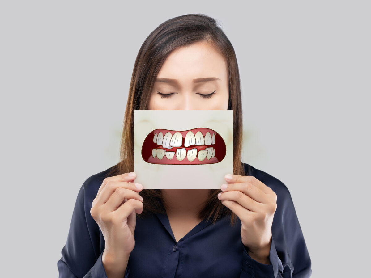 What Are The Five Most Common Dental Problems?