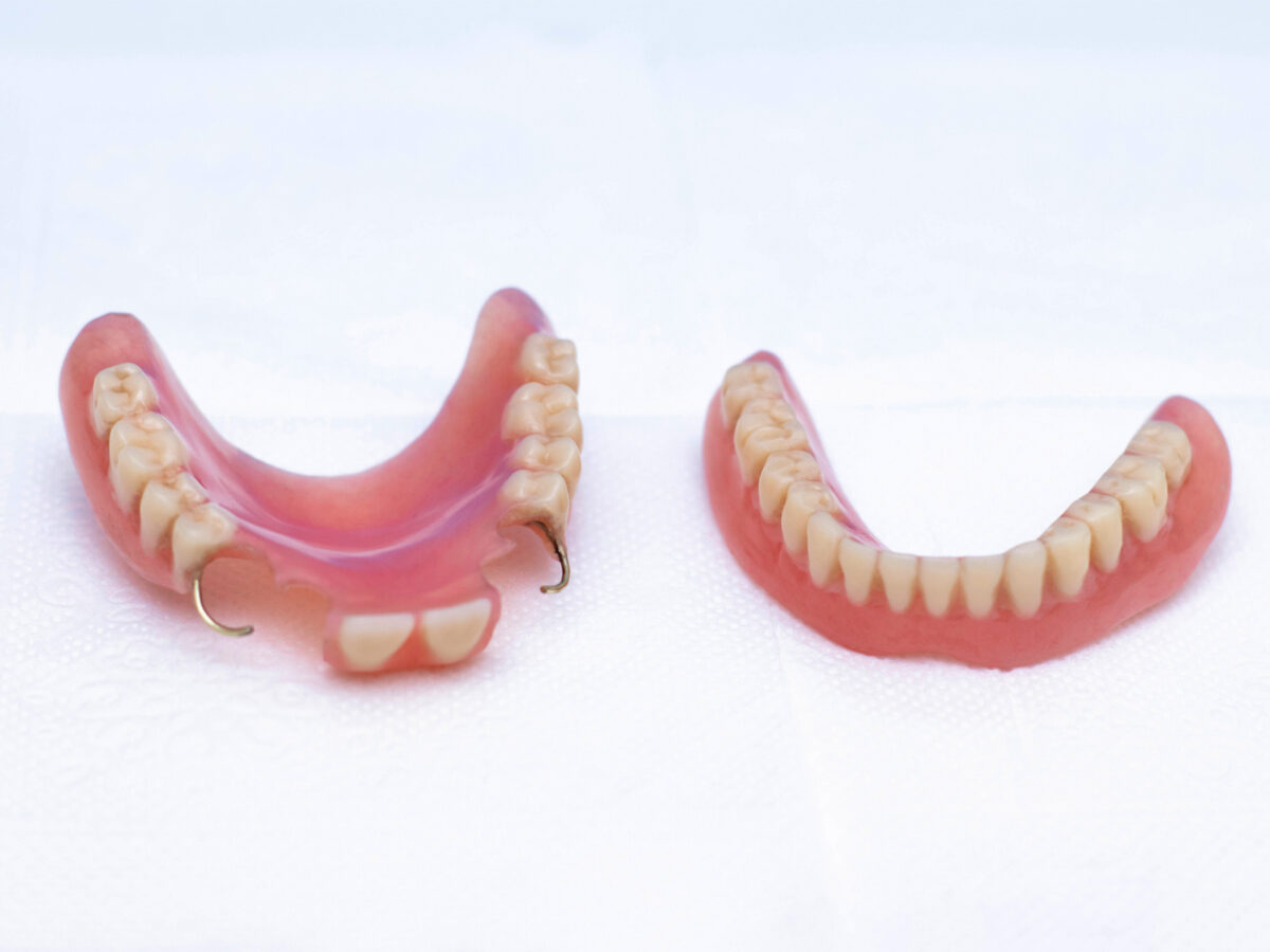 Denture Reline Vs Rebase: What You Need To Know