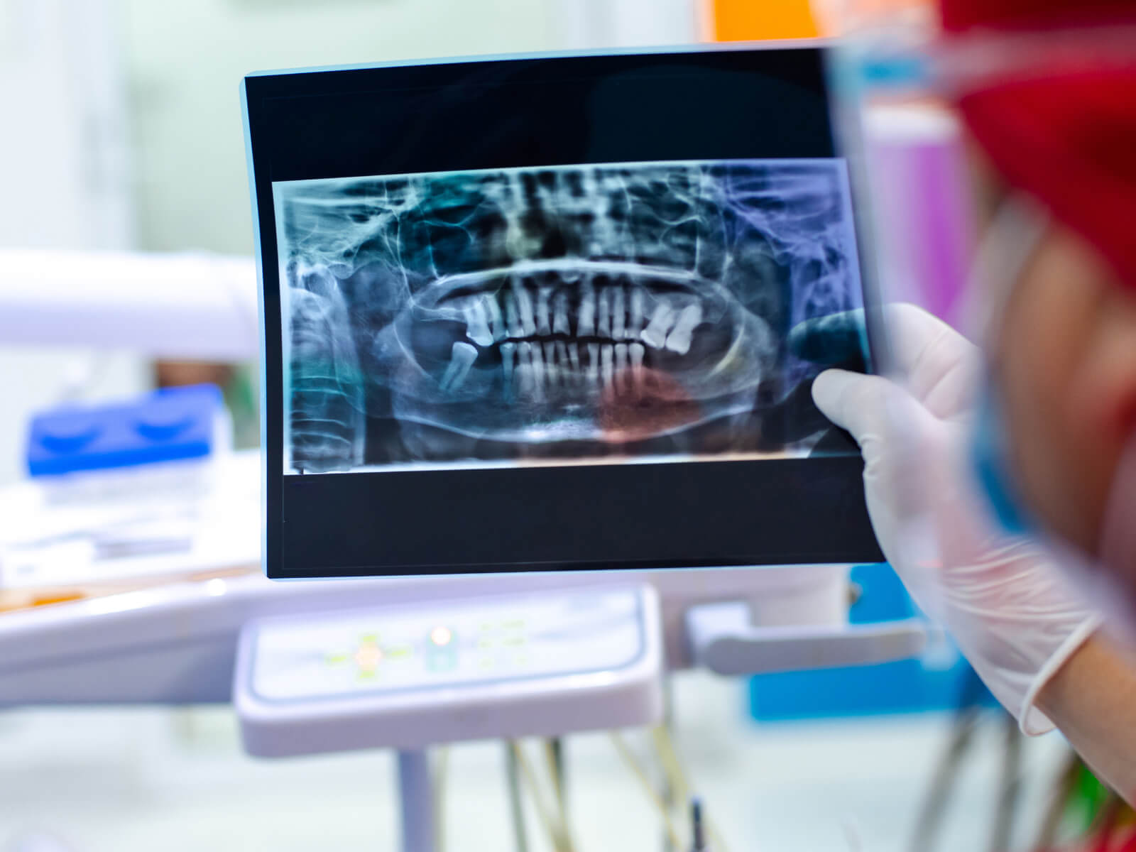 All-On-4 Implants: The Service That Restores Your Smile In One Visit