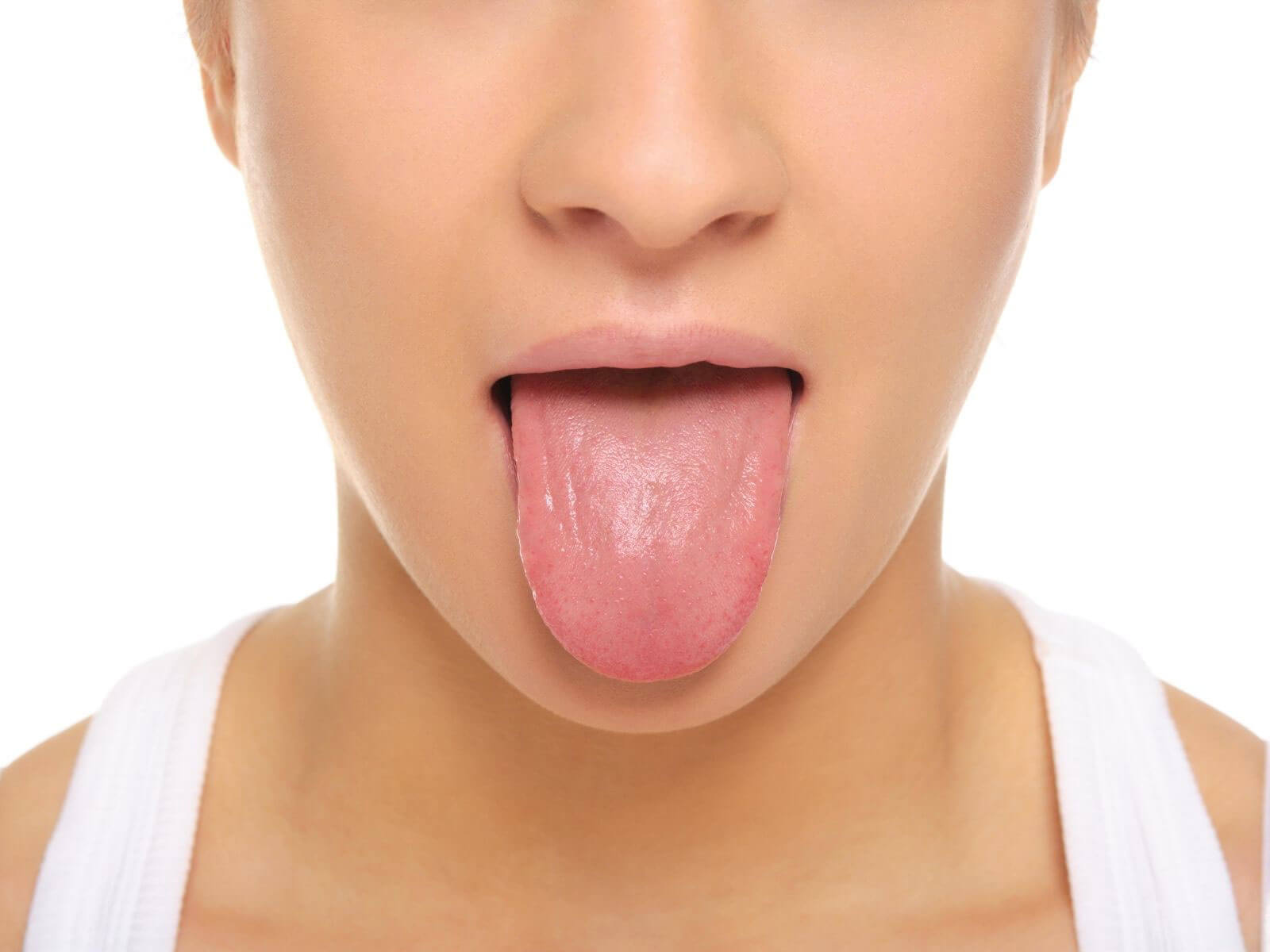 Why Tongue Posture Matters For Your Oral Health