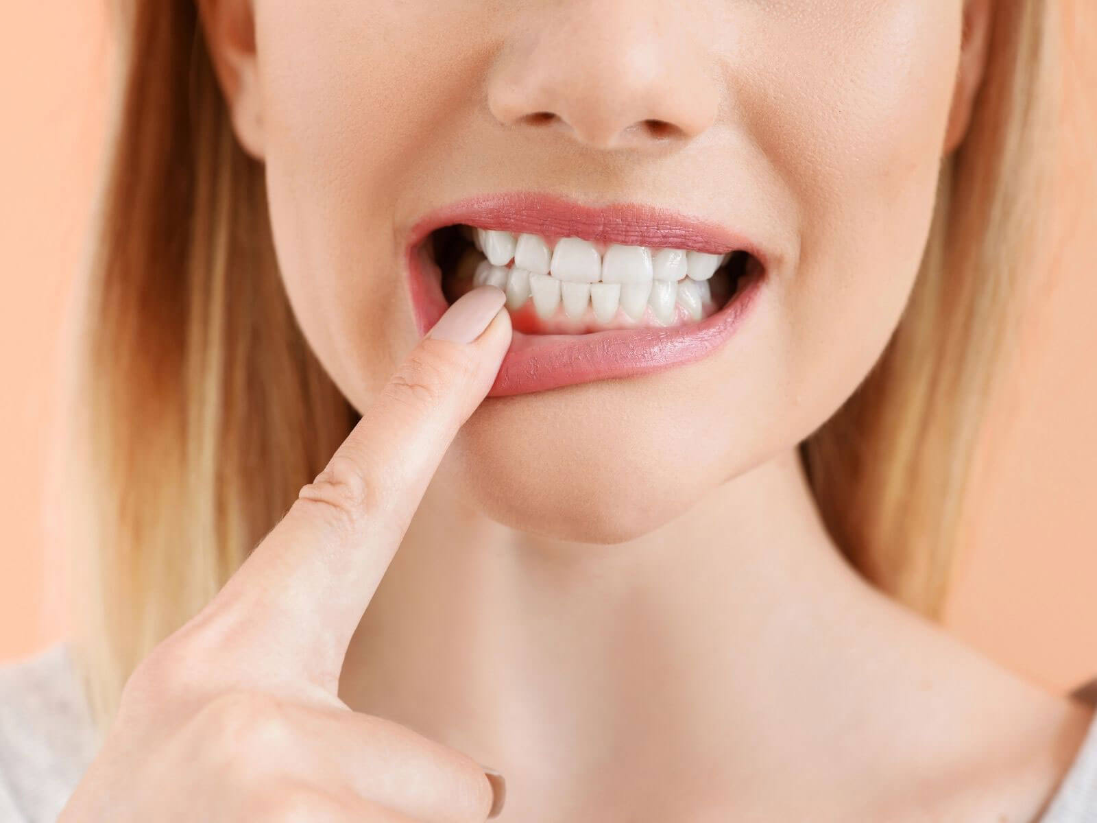 Can Receding Gums Grow Back?