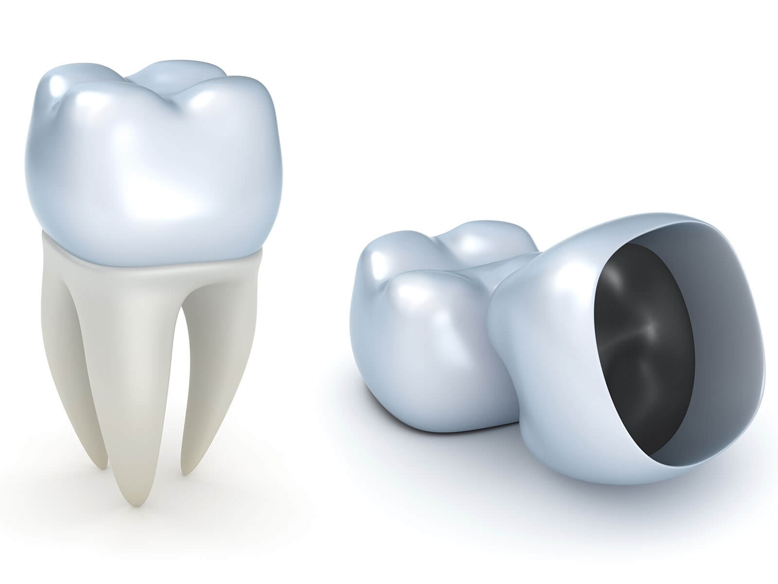 Root Canal vs Filling vs Crown: What’s the Difference