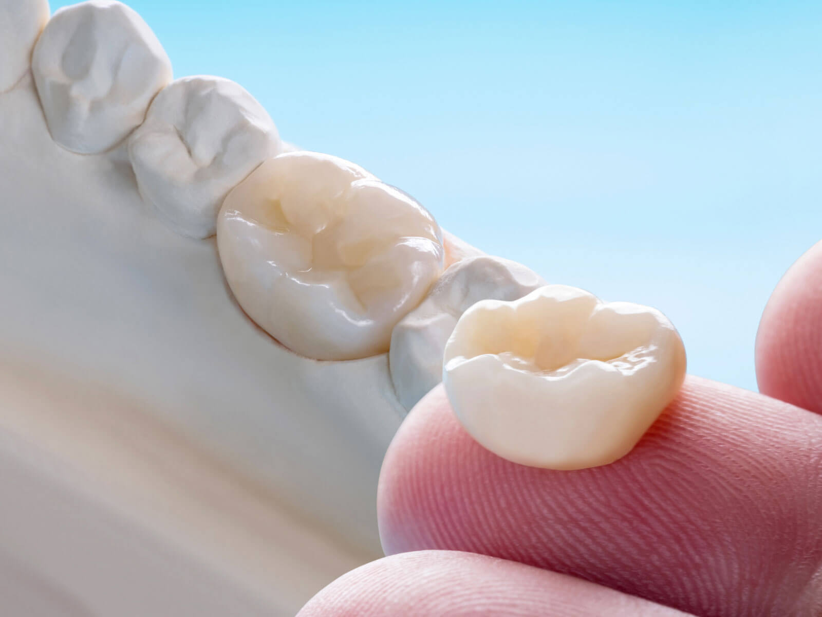 Dental Crown Types: Which One Is Right for Your Tooth?